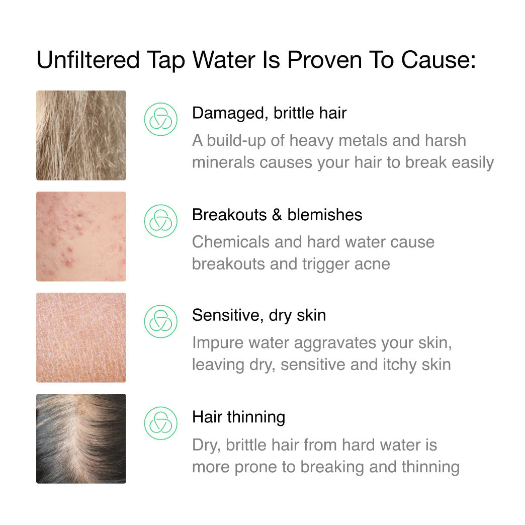 NALVIO Shower Filter – 4-Stage Purifier for Hair & Skin